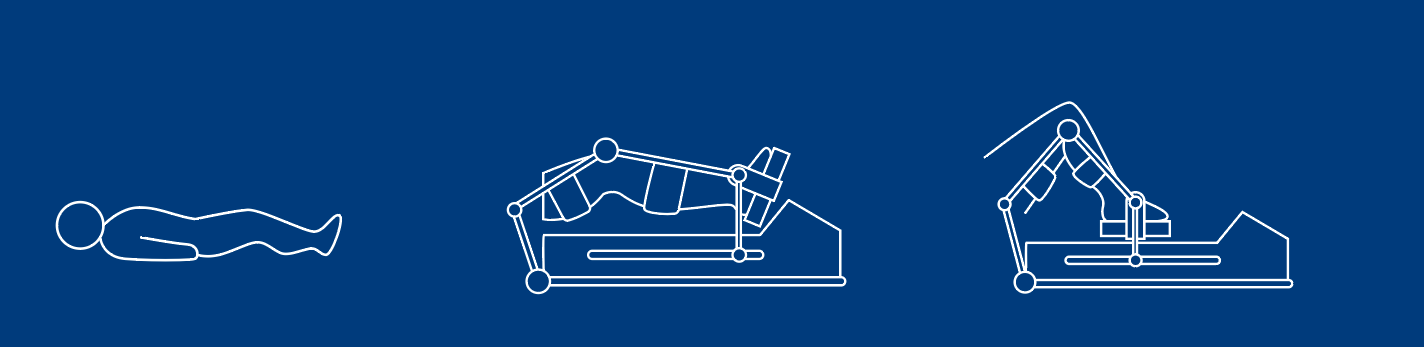 Patient Positioning rehabilitation workflow illustration